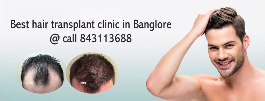 hair transplant clinic in bangalore